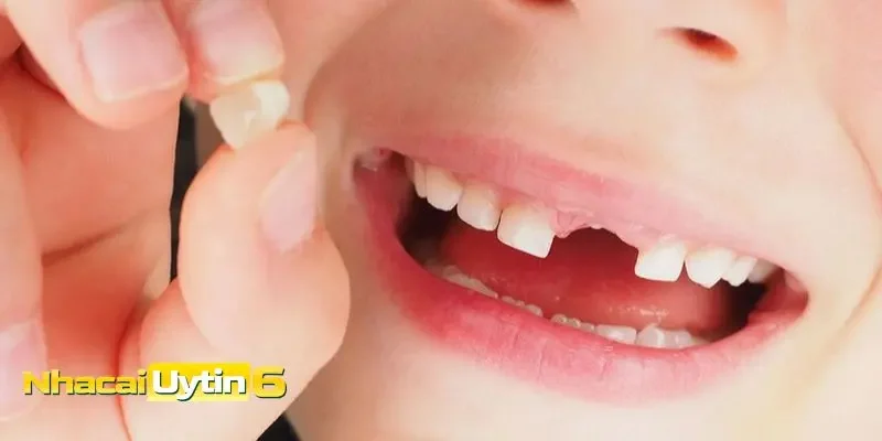 Mơ thấy rụng răng liên quan đến tiền bạc
